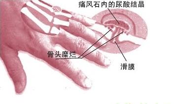 (w)õʹL(fng)ί]_ʹL(fng)ļҺ 
P(gun)I: